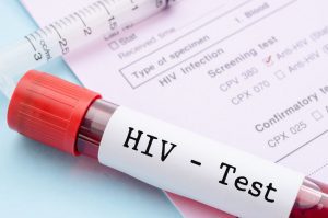 HIVAID VIRUS