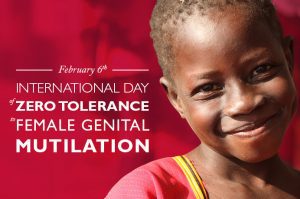 fgm