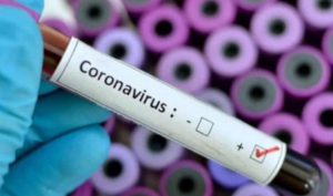 Coronavirus-Kano