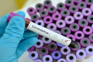 Coronavirus_750x499