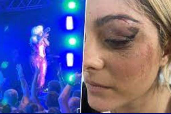 Bebe Rexha Injured on Stage After Being Hit With a Cell Phone - Parade