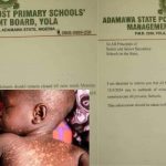 Adamawa extends schools resumption by one week amid measles outbreak