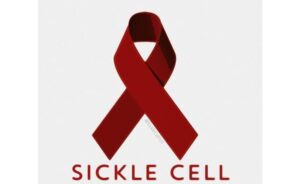 sickle-cell