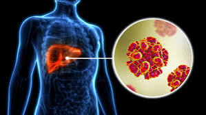 OMS Exorta África a Quebrar Barreiras ao Tratamento da Hepatite – Tendências de Notícias
